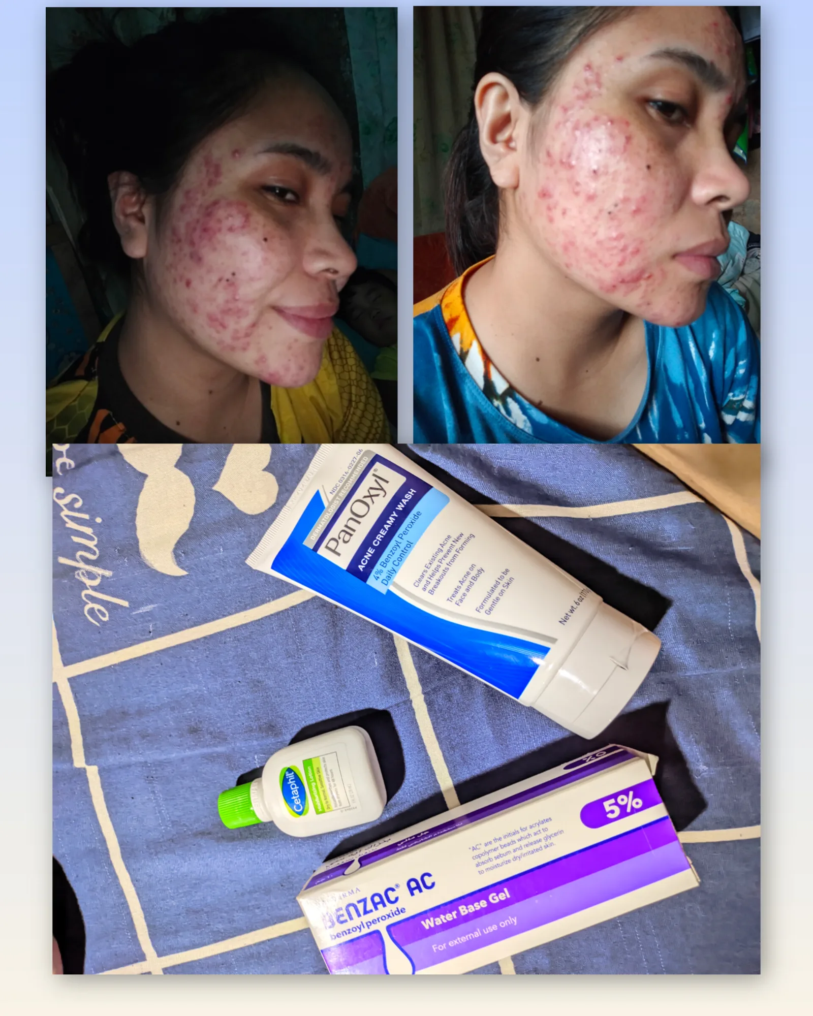 my holy grail skincare